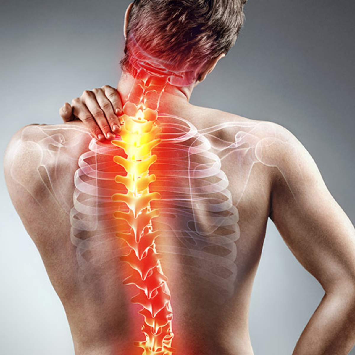 Bệnh lý cong vẹo cột sống là tình trạng cột sống bị lệch sang một bên